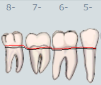 Tandsæt gingiva og pochedybde